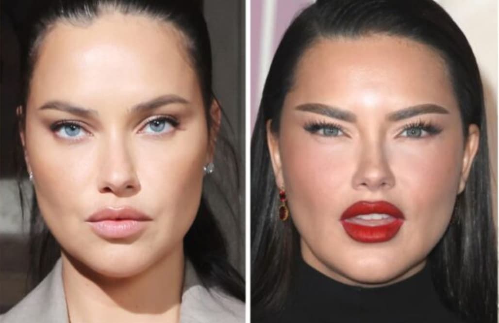 Adriana Lima Weight Gain